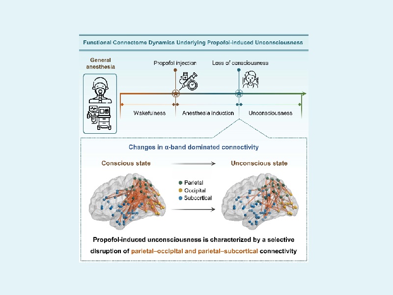 上海交大心理学院袁逖飞教授与合作者解码丙泊酚麻醉下的人脑意识连接组